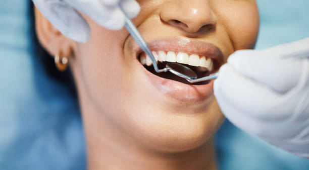 Best Broken Tooth Emergency  in Pocono Springs, PA